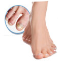 Best Dry Cracked Heels Repair Moisturizing Tea Tree Foot Cream